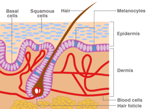 سرطان پوست و ملانوم - سلولهای ملانوسیت سرطان پوست و ملانوم - سلولهای ملانوسیت