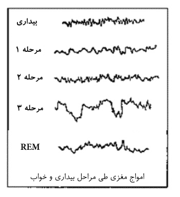 امواج مغزی طی خواب REM