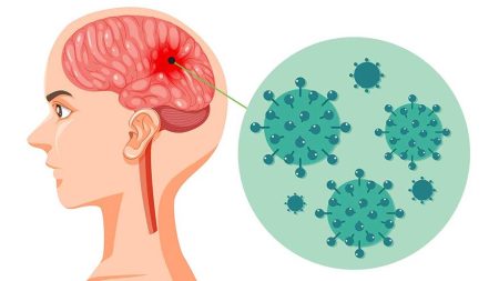 علائم بیماری مننژیت ویروسی باکتریایی درمان پیشگیری