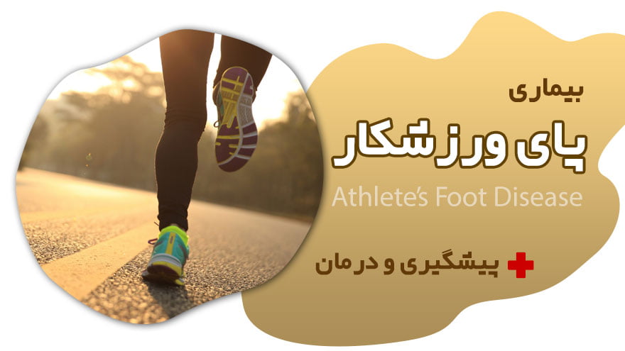 بیماری پای ورزشکاران