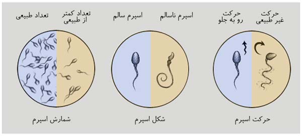 تفسیر آزمایش اسپرم و مایع منی