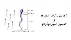 تفسیر آزمایش اسپرم و اسپرموگرام طبیعی